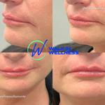 Walk-in Wellness - photo 5