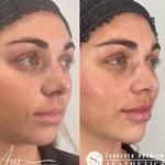 Sarasota Premier Aesthetics - photo 8