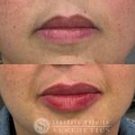 Sarasota Premier Aesthetics - photo 9