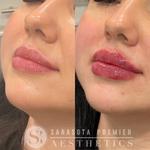 Sarasota Premier Aesthetics - photo 10