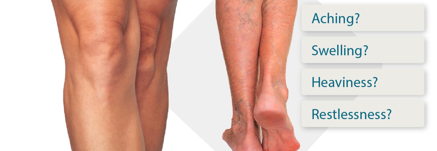 Edmonds Complete Vein Care cover photo