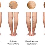 Edmonds Complete Vein Care - photo 4