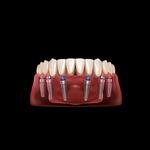 Clínica Dental Tapias | Dentista en Alcorcón - photo 1