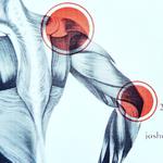 Sacramento Massage & Trigger Point Therapy - photo 2