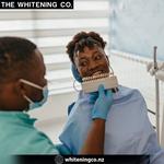 The Whitening Co - photo 1