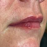 Regenesis Aesthetics & Skin Health Clinic - photo 3