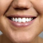 Dental Clinic Cooloongup - Infinite Smiles - photo 5