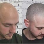 Inkon Hair Clinic - photo 1