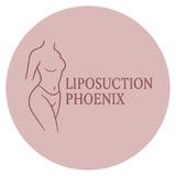 Liposuction Phoenix - Laser Tag in Phoenix