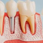Whitey Smile Orthodontics and Implants Dental Center - Ras Al-Khaimah - photo 3