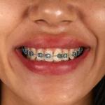 Whitey Smile Orthodontics and Implants Dental Center - Ras Al-Khaimah - photo 4