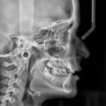 Whitey Smile Orthodontics and Implants Dental Center - Ras Al-Khaimah - photo 5