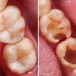 Whitey Smile Orthodontics and Implants Dental Center - Ras Al-Khaimah - photo 6