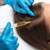 PRP Hair Loss Treatment - Skin Care in Freehold