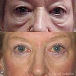 Your Eyelids - photo 3