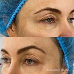 Your Eyelids - photo 4