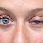 Your Eyelids - photo 5