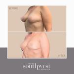 Southwest Breast & Aesthetics - photo 2