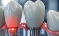 Heritage Family Dental - Dental Technicians/Dentures/Implants