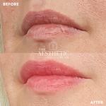 The Aesthetic Plan - photo 6