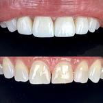 M Dental Greenwich - photo 8