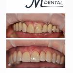 M Dental Greenwich - photo 9