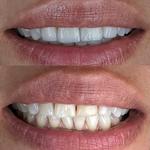 M Dental Greenwich - photo 10