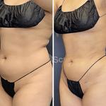 Novo Sculpt - photo 3