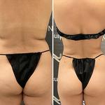 Novo Sculpt - photo 4