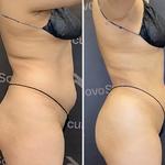 Novo Sculpt - photo 7