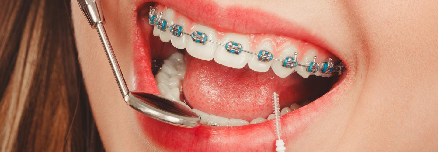 Beach Cities Dental Group cover photo