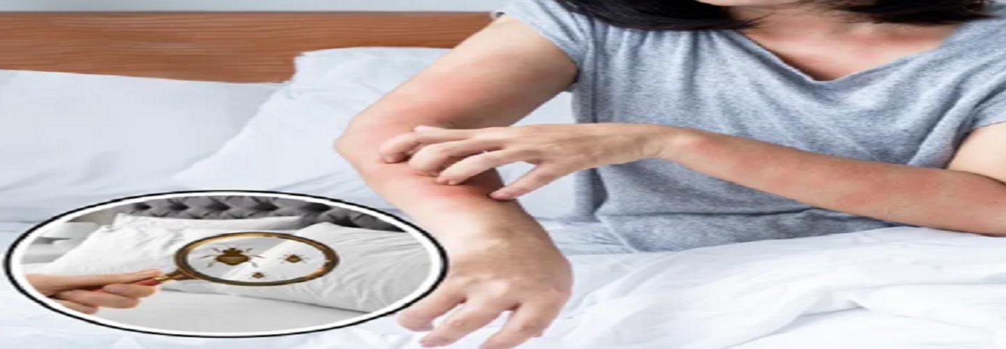 EcoForce BedBug Services cover photo