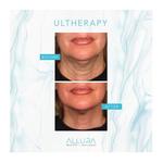 AlluraMD Aesthetics + Wellness | Wellington - photo 1