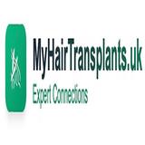 My Hair Transplants - Hair Extensions in Stanmore
