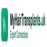 My Hair Transplants - Hair Extensions in Stanmore