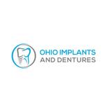 Ohio Implants and Dentures
