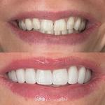 Centerport Cosmetic & Implant Dentistry - photo 1