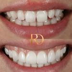 Ringway Dental - photo 1