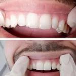 Vancouver Main Dentist - photo 3