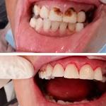 Vancouver Main Dentist - photo 4