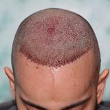 Royal cosmetic surgery - Health & Medical in Islamabad