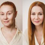 Derma Radiance & Wellness - photo 3