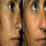 Derma Radiance & Wellness - photo 4