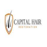 Capital Hair Restoration - Hair Transplant - Health & Medical in Oxford