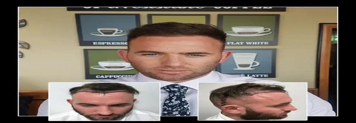 Capital Hair Restoration - Hair Transplant cover photo