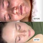 Skin Bliss Med Spa - photo 5