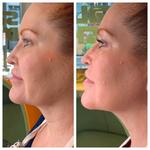 Le Bella Spa - photo 4