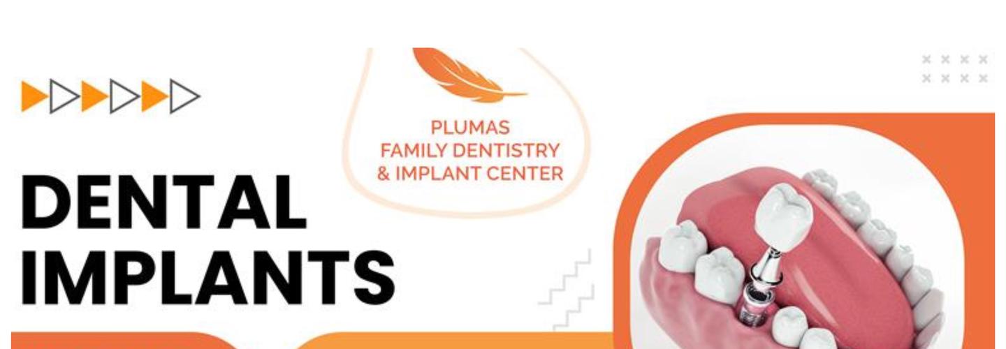 Plumas Family Dentistry & Implant Center cover photo