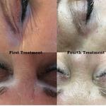 Complete Care Acupuncture and Wellness - photo 3