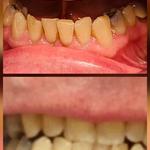 Brighter Smiles Cosmetic Teeth Whitening - photo 7